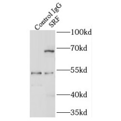 Serum Response Factor (SRF) Antibody