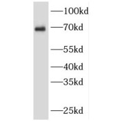 WB analysis of HeLa cells, using SRF antibody (1/400 dilution).