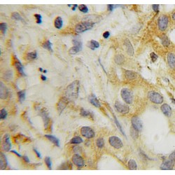 Serum Response Factor-Binding Protein 1 (SRFBP1) Antibody