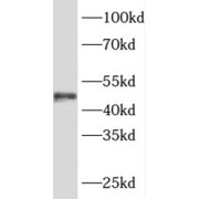 WB analysis of mouse heart tissue, using SRFBP1 antibody (1/300 dilution).