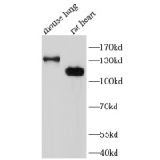WB analysis of Mouse lung and Rat heart tissue lysates, using SRGAP2 antibody (1/1000 dilution).