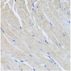 Sorcin (SRI) Antibody