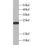 WB analysis of MCF7 cells, using SRI antibody (1/1000 dilution).