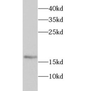 WB analysis of HepG2 cells, using SRP19 antibody (1/1000 dilution).