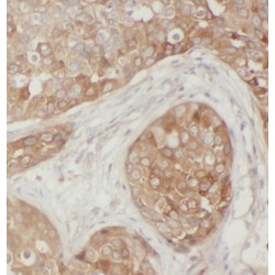 Signal Recognition Particle 54 (SRP54) Antibody