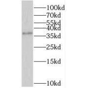 WB analysis of mouse brain tissue, using SRR antibody (1/1000 dilution).