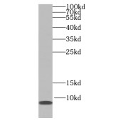 WB analysis of human liver tissue, using SS18L2 antibody (1/500 dilution).