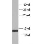 WB analysis of SW620 cells, using SSBP1 antibody (1/1000 dilution).