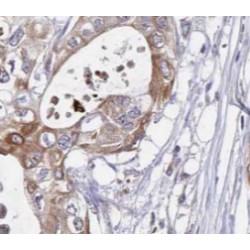 Signal Sequence Receptor Subunit Delta (SSR4) Antibody