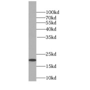 WB analysis of HeLa cells, using SSR4 antibody (1/500 dilution).