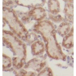 Somatostatin Receptor Type 2 (SSTR2) Antibody