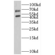 WB analysis of human placenta tissue, using SSTR5 antibody (1/1200 dilution).