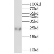 WB analysis of PC-3 cells, using SSX1 antibody (1/300 dilution).