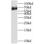 WB analysis of HEK-293 cells, using SSX2IP antibody (1/500 dilution).