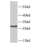 WB analysis of Raji cells, using SSX5 antibody (1/1000 dilution).