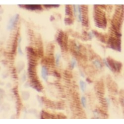 Syntenin 2 (ST2) Antibody