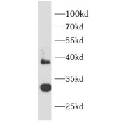 WB analysis of mouse brain tissue, using IL1RL1 antibody (1/1000 dilution).