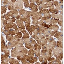 Syntenin 2 (ST2) Antibody