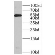 WB analysis of HeLa cells, using ST3GAL4 antibody (1/300 dilution).
