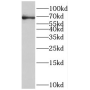 WB analysis of human stomach tissue, using ST6GALNAC1 antibody (1/1200 dilution).