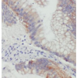 Alpha-N-Acetylgalactosaminide Alpha-2,6-Sialyltransferase 6 (ST6GALNAC6) Antibody