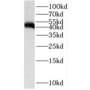 WB analysis of SH-SY5Y cells, using ST8SIA1 antibody (1/1000 dilution).