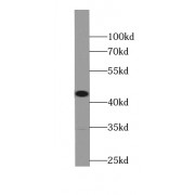 WB analysis of mouse liver tissue, using ST8SIA3 antibody (1/800 dilution).