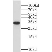 WB analysis of human brain tissue, using Stanniocalcin 2 antibody (1/500 dilution).