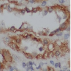 Stanniocalcin 2 (STC2) Antibody