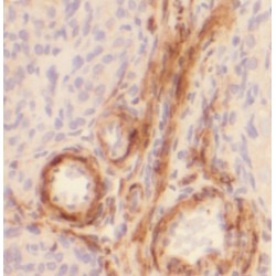 Steroidogenic Acute Regulatory Protein, Mitochondrial (STAR) Antibody