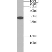 WB analysis of human adrenal gland tissue, using STAR antibody (1/500 dilution).