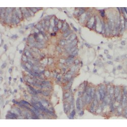 StAR Related Lipid Transfer Domain Containing 7 (STARD7) Antibody