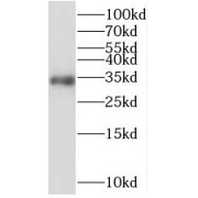 WB analysis of HepG2 cells, using STARD7 antibody (1/500 dilution).