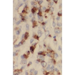 StAR Related Lipid Transfer Domain Containing 8 (STARD8) Antibody