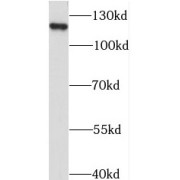 WB analysis of HEK-293 cells, using STARD8 antibody (1/400 dilution).