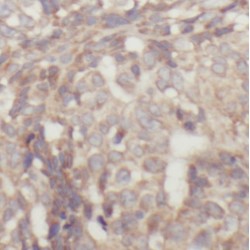 Signal Transducer And Activator of Transcription 1 (STAT1) Antibody