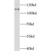 WB analysis of HeLa cells, using STAT2 antibody (1/500 dilution).