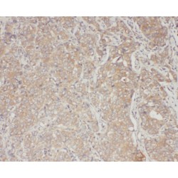 Signal Transducer And Activator of Transcription 3 (STAT3) Antibody