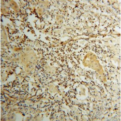 Signal Transducer And Activator of Transcription 3 (STAT3) Antibody