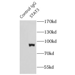 Signal Transducer And Activator of Transcription 3 (STAT3) Antibody