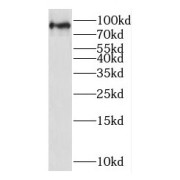 WB analysis of K-562 cells, using STAT3 antibody (1/500 dilution).