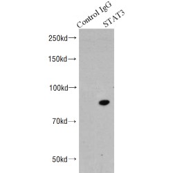 Signal Transducer And Activator of Transcription 3 (STAT3) Antibody