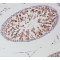 Signal Transducer And Activator of Transcription 4 (STAT4) Antibody