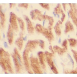 STEAP2-Specific Antibody