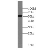 WB analysis of fetal human brain tissue, using STEAP2-Specific antibody (1/300 dilution).