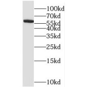 WB analysis of Jurkat cells, using STIP1 antibody (1/800 dilution).