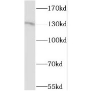 WB analysis of SKOV-3 cells, using STK10 antibody (1/600 dilution).