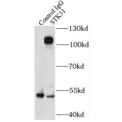 Serine/Threonine Kinase 31 (STK31) Antibody