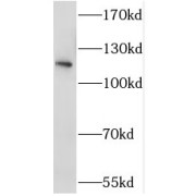 WB analysis of mouse testis tissue, using STK31 antibody (1/600 dilution).