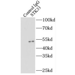 Serine/Threonine Kinase 33 (STK33) Antibody